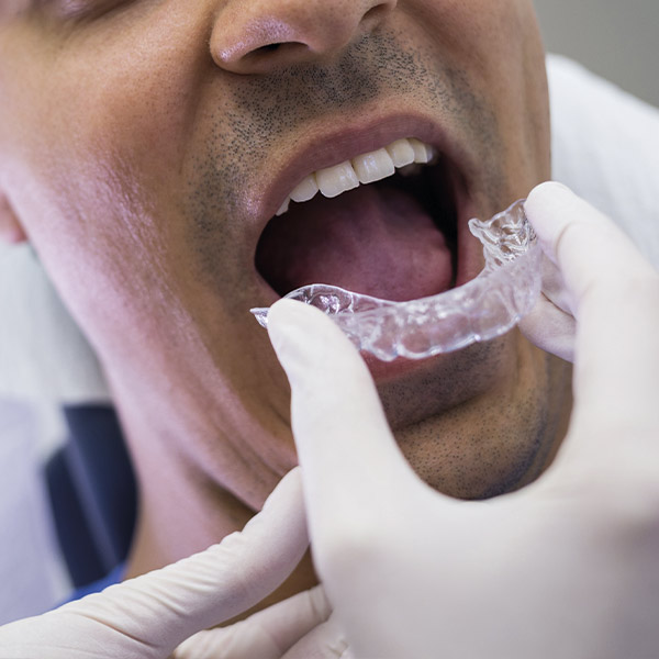 Ortodoncia en Zaragoza Clínica Dental Nordent